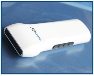 Linear Wireless Ultrasound Probe