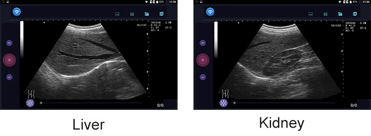 Convex Ultrasound Scan Result