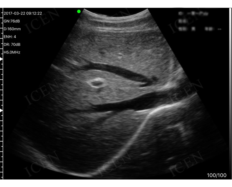 Resultaten van draadloze convex ultrasone scanner