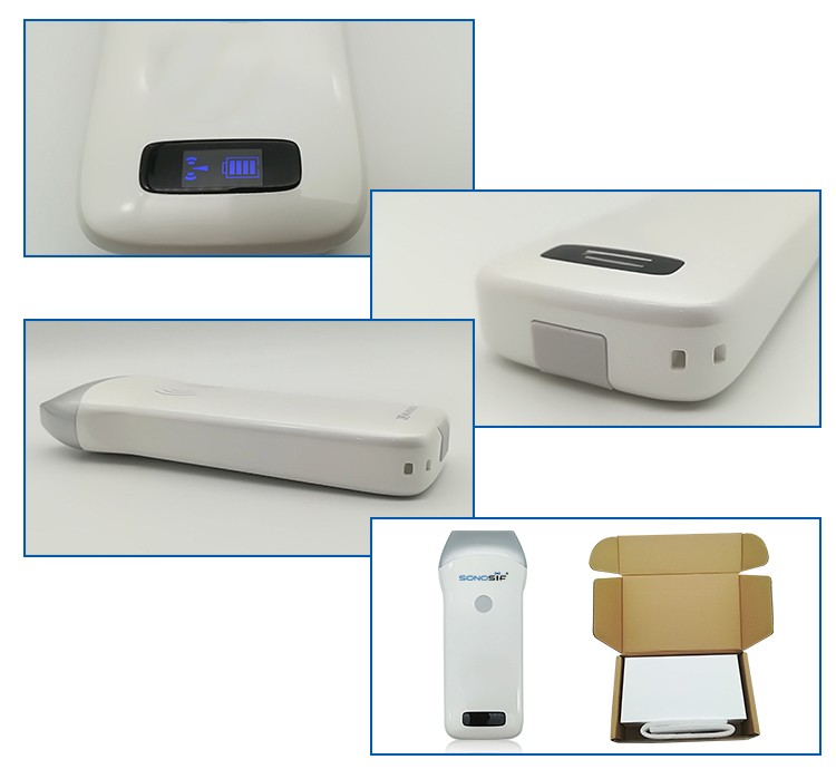 Wi-Fi Ultrasound Scanner Lineair 7.5 Mhz 80 Elementen