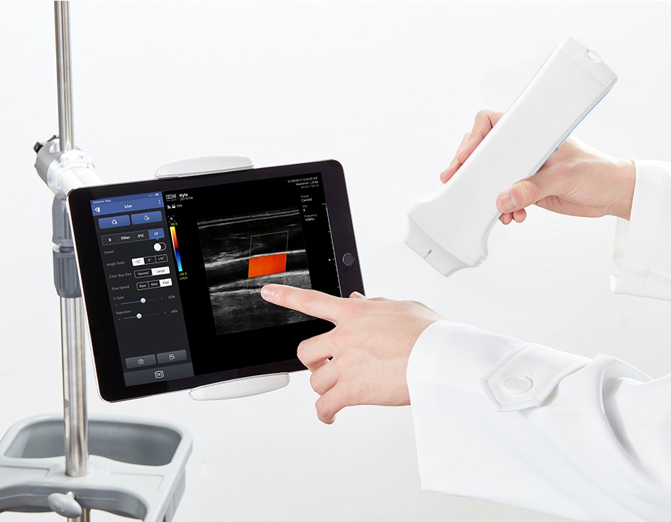 Scanner ad ultrasuoni wireless Color Doppler lineare