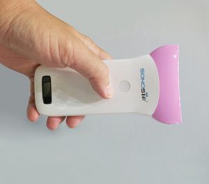 Pengimbas Ultrasound PW Doppler