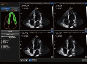 Scanner a ultrasuoni multitesta per laptop Color Doppler LMH1CD