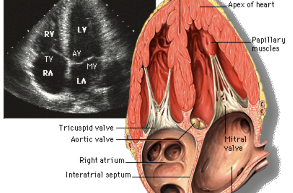 Cardiac Ultrasound Changes Echocardiogram Fact Sheets Yale Cardiac Ultrasound Changes Echocardiogram Fact Sheets Yale