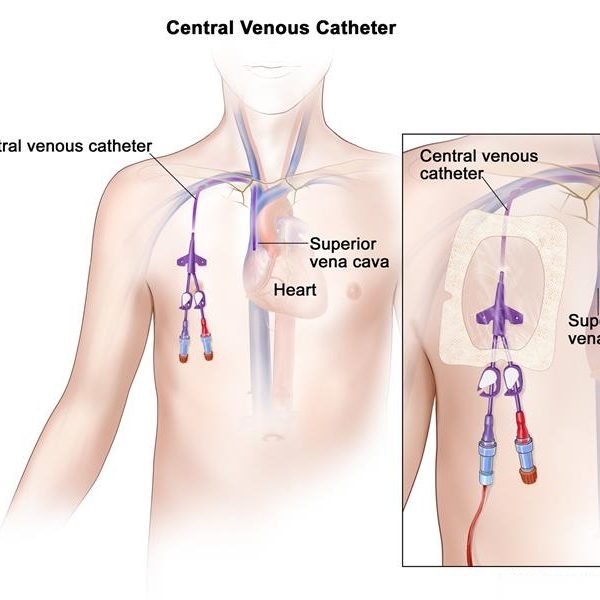 TTE: Transthoracic Echocardiogram - SONOSIF - by SIFSOF, California