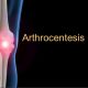 Ultralydstyrt artrosentese