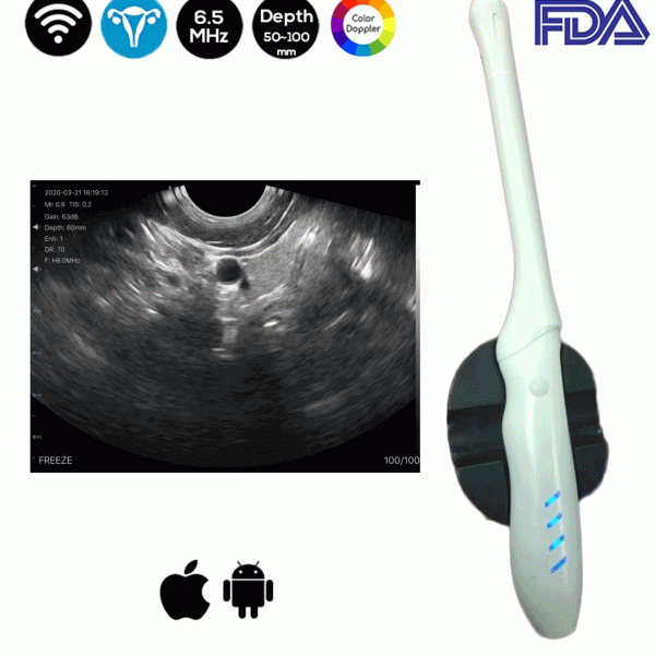 Draadloze transvaginale echografiescanner Color Doppler FDA TRC