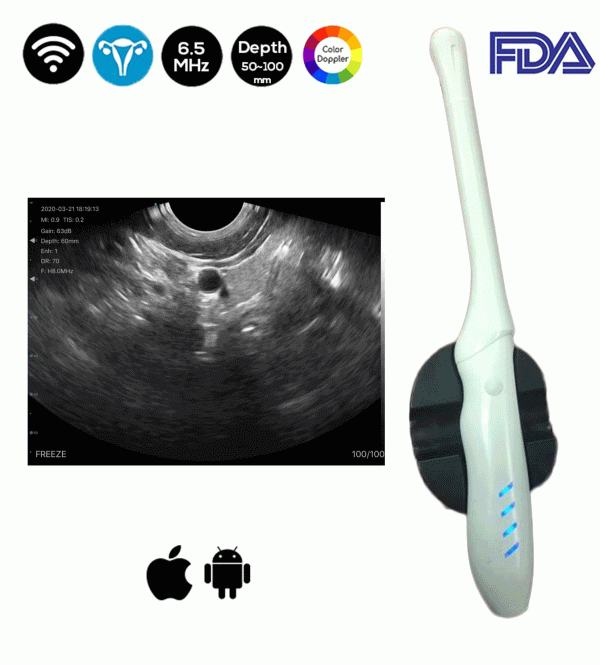 Escáner de ultrasonido transvaginal inalámbrico Doppler a color FDA TRC