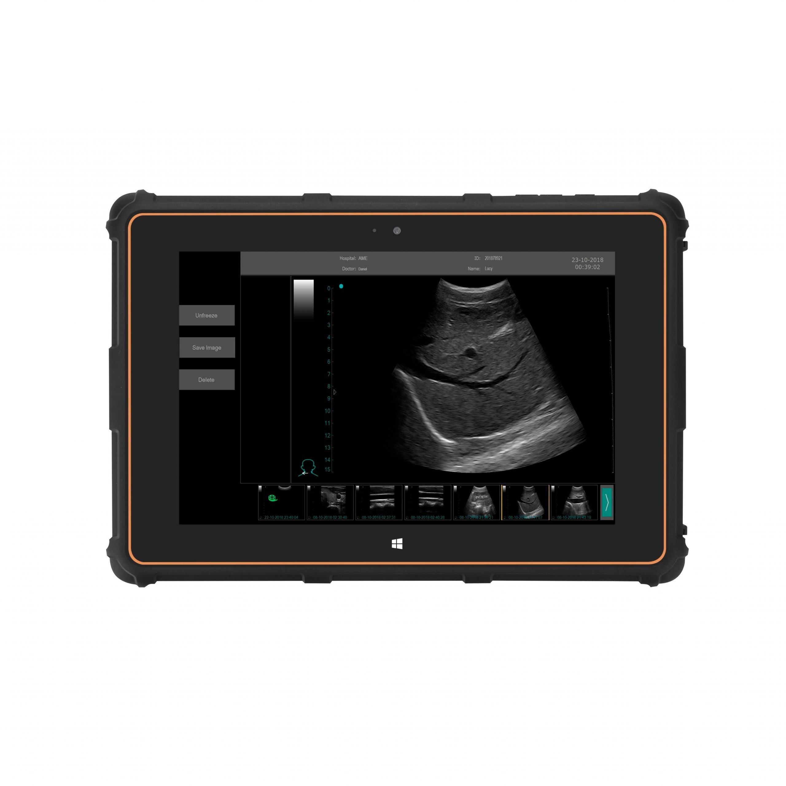 Scanner a ultrasuoni portatile USB-UL1