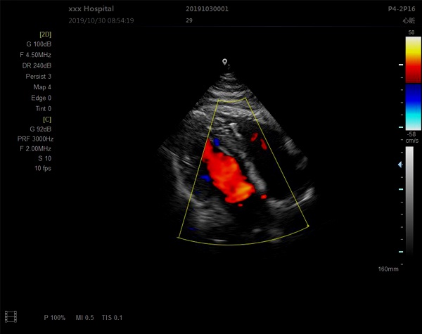 Scan-resultaten-van-kleur-Doppler-Convex-Diagnostic-Ultrasound-Scanner-CD-UL1