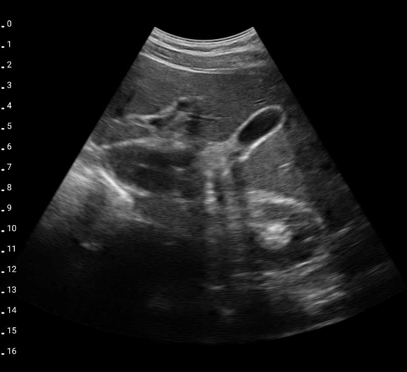 risultati-scansione-Scanner a ultrasuoni CD-1UL