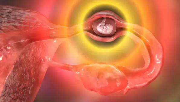 تشخيص الحمل خارج الرحم الموجه بالموجات فوق الصوتية