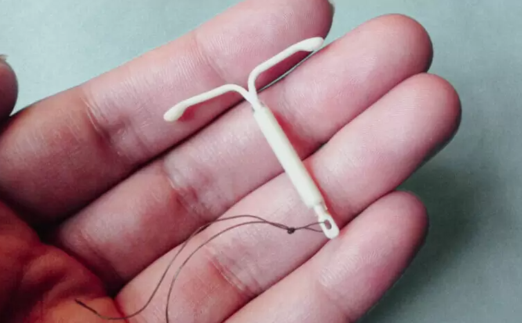 IUD 삽입 초음파 모니터링