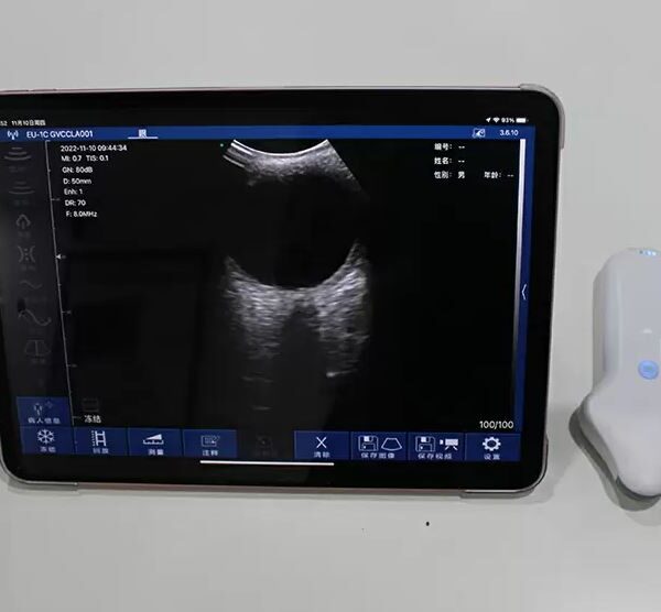 Ophtalmic Color Doppler Convex Ultrasound Scanner CC-32 with 64 channels and 80 element  