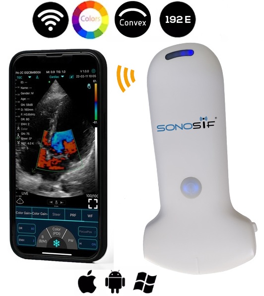 convex handheld ultrasound machine