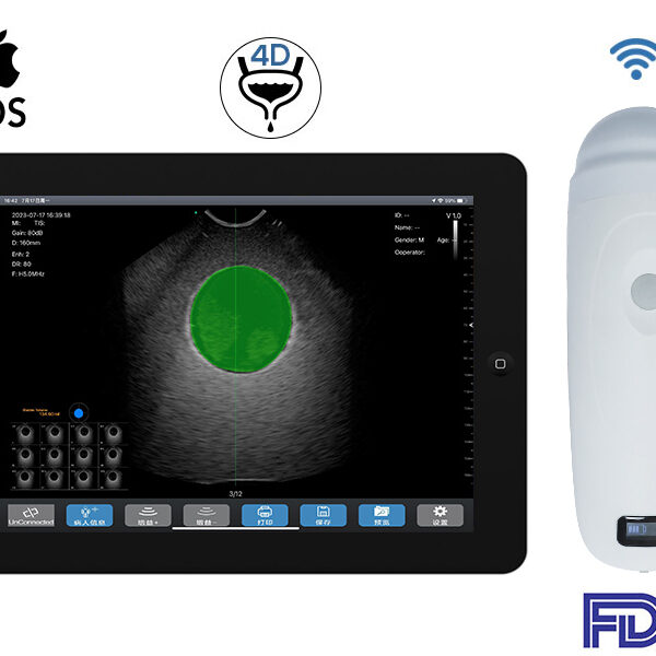 4D Bladder Ultrasound Scanner: B6-4D