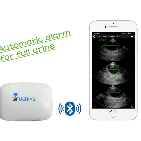 Bluetooth Bladder Ultrasound Scanner