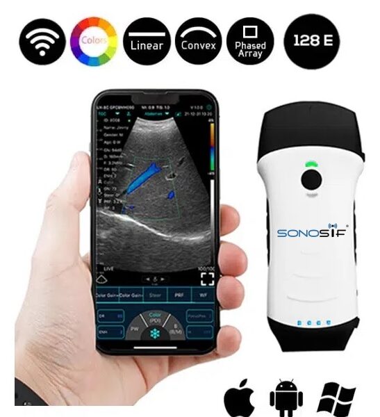 Handheld porrtable ultrasound scanner