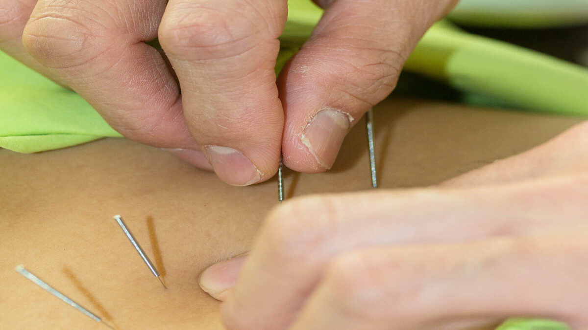 Acupuncture Evaluating the biomechanical effects of needle manipulation on tissue