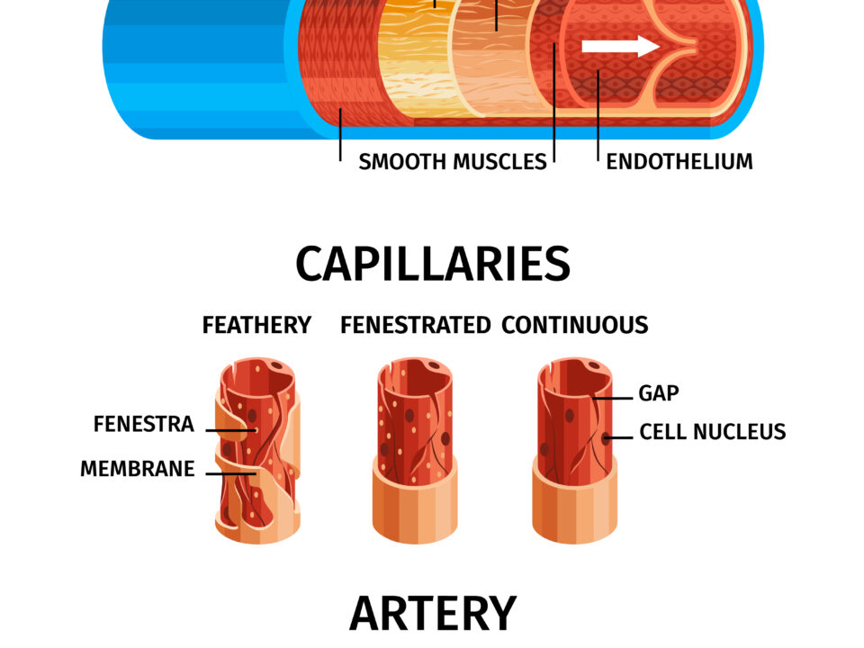Arterial Lines