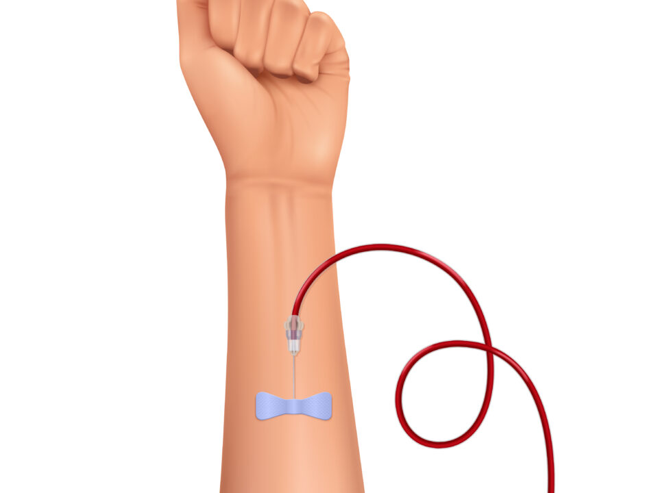 PICC Peripherally Inserted Central Catheter