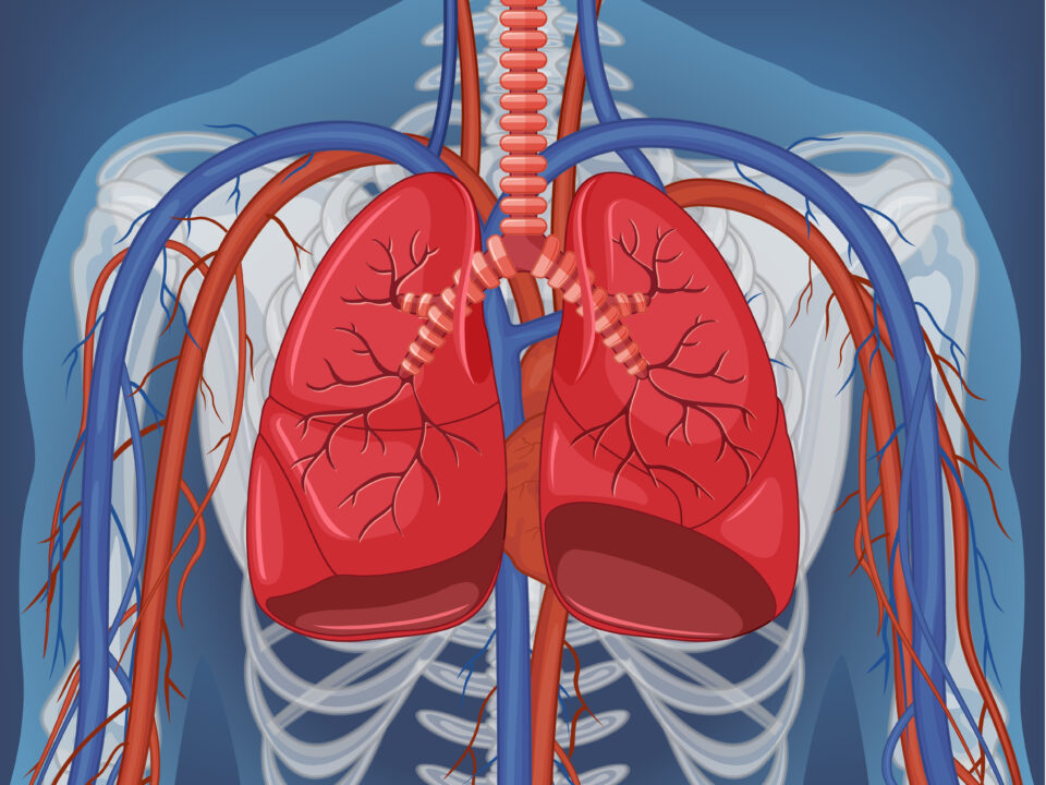 Thoracentesis