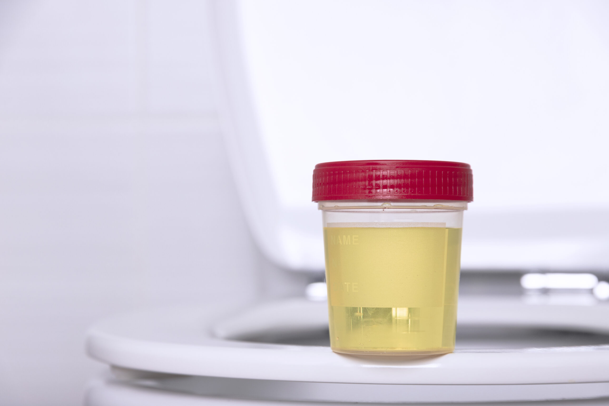 Trasformare la cura della vescica Monitoraggio del volume delle urine in tempo reale utilizzando gli ultrasuoni in sistemi indossabili