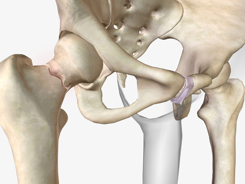 Ultrasound-Guided Coxofemoral Joint