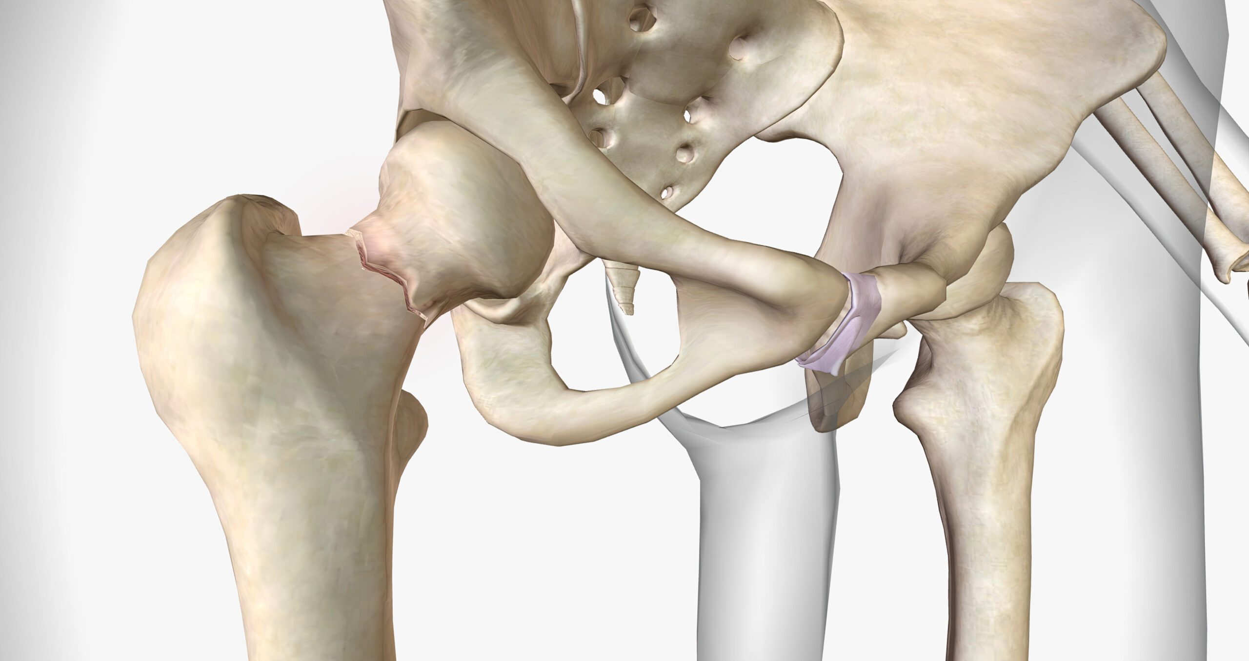 Ultrasound-Guided Coxofemoral Joint