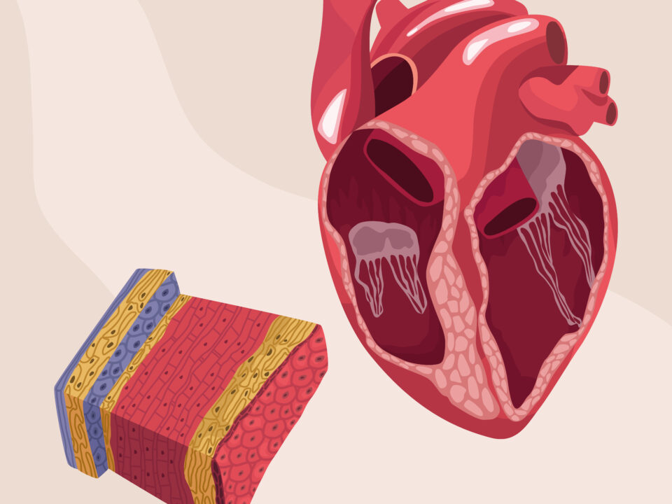 Ultrasound-Guided Enlarged Heart Diagnosis