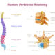 Ultrasound-Guided Facet Nerve Block