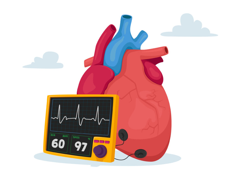 Ultrasound scanner-guided Ejection Fraction measurement