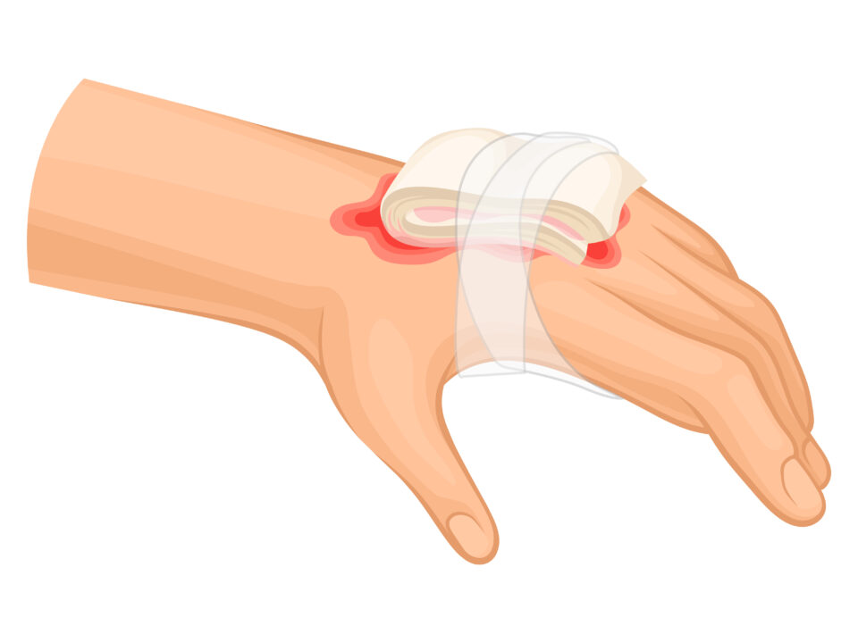 Blood Supply for Cutaneous Flap
