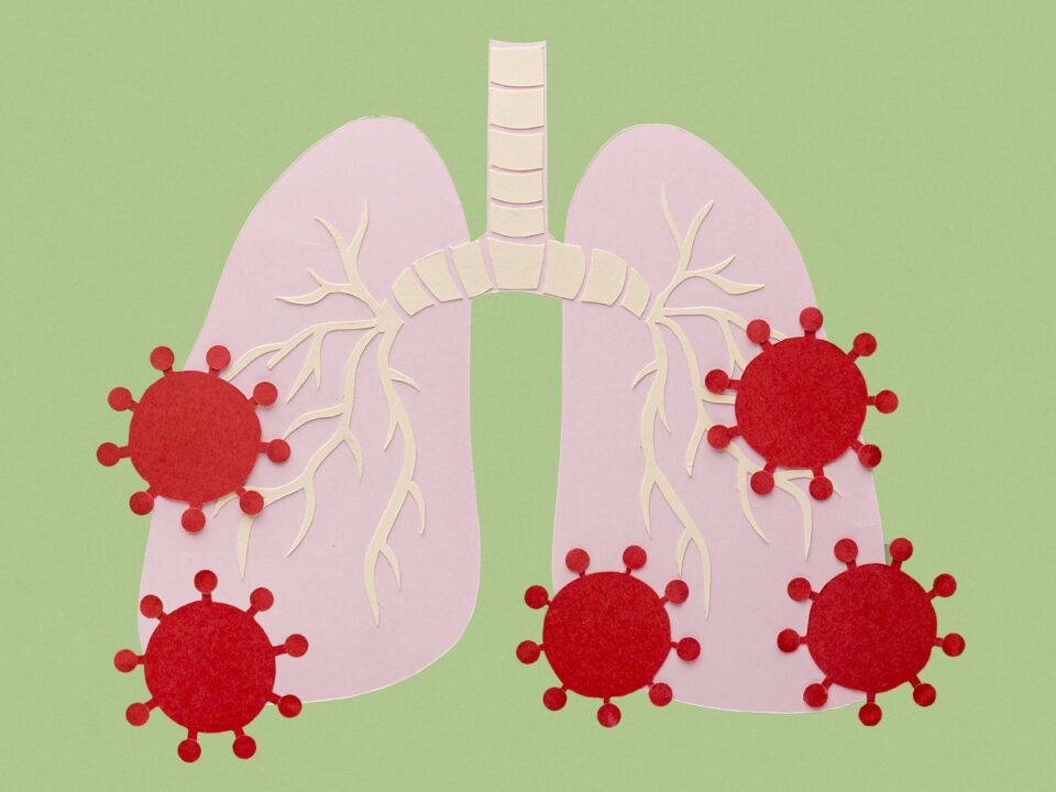COVID-19, Lung Ultrasound
