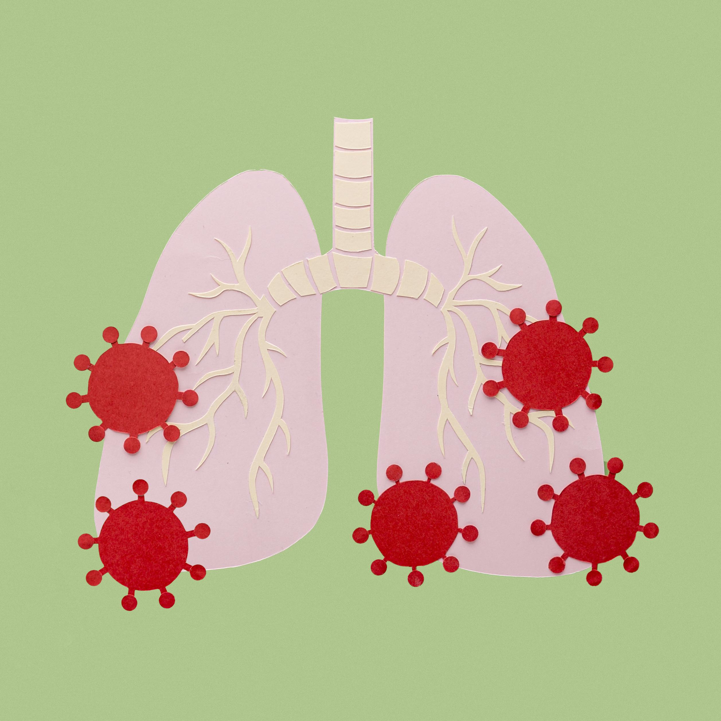 COVID-19, Lung Ultrasound