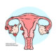 Dyp infiltrerende endometriose (DIE)