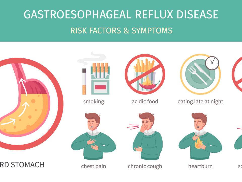 Gastroesophageal Reflux Disease (GERD)