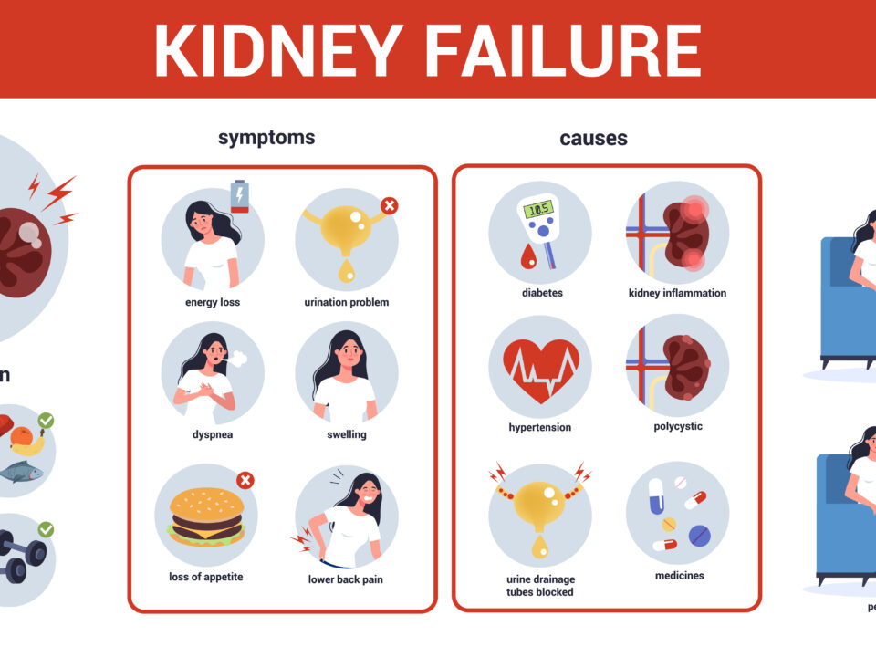 Hemodialysis Catheters
