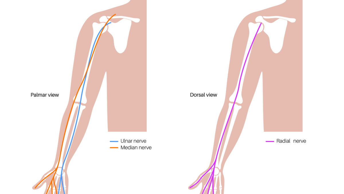 Lymphaticovenular anastomosis LVA