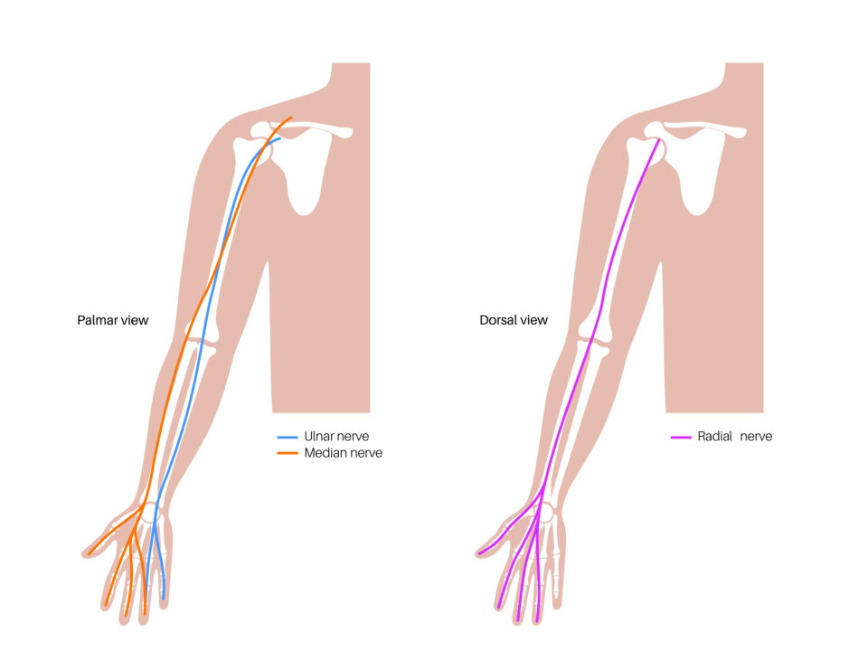 Lymphaticovenular anastomosis LVA