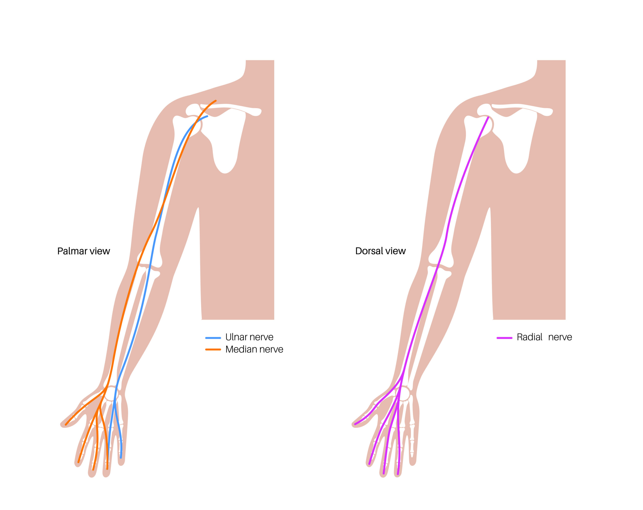 Lymphaticovenular anastomosis LVA