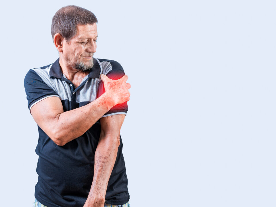 Traumatic Extremity Injuries